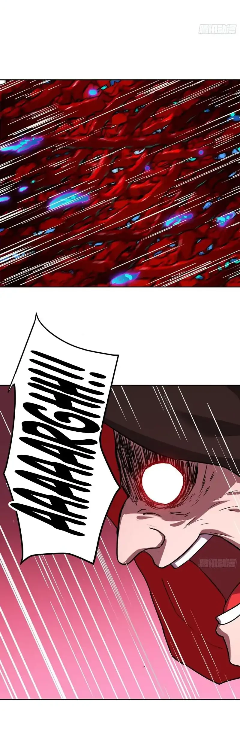 Mood Disorder Chapter 21 Gambar 4