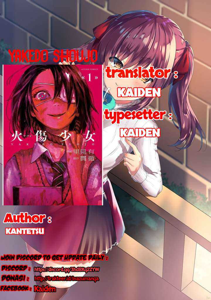 Baca Komik Yakedo Shoujo Chapter 04 Gambar 1