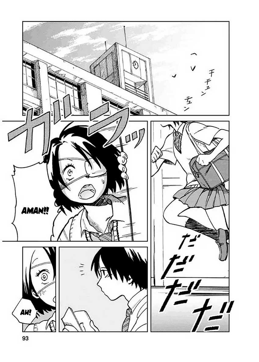 Yakedo Shoujo Chapter 04 Gambar 3