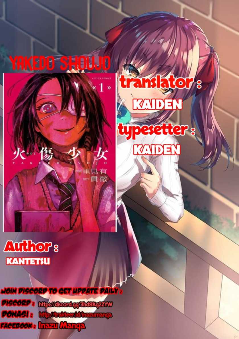 Baca Manga Yakedo Shoujo Chapter 03 Gambar 2