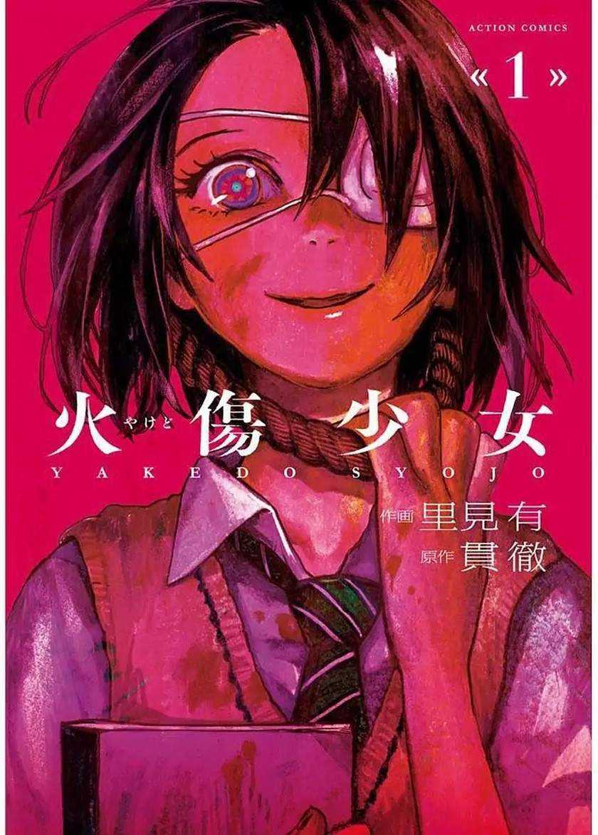 Baca Manga Yakedo Shoujo Chapter 01 Gambar 2