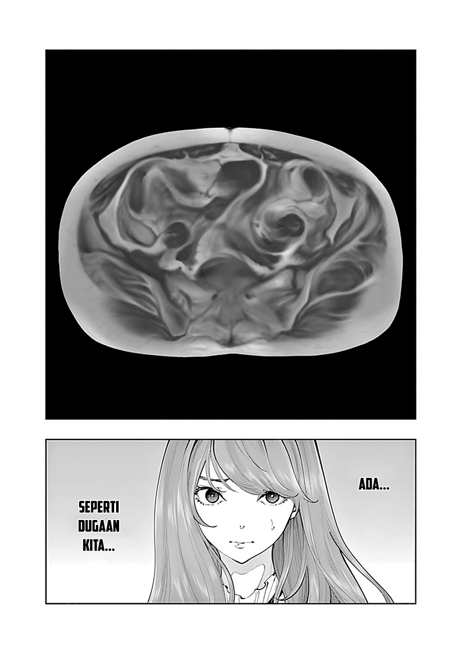 Radiation House Chapter 67 Gambar 16