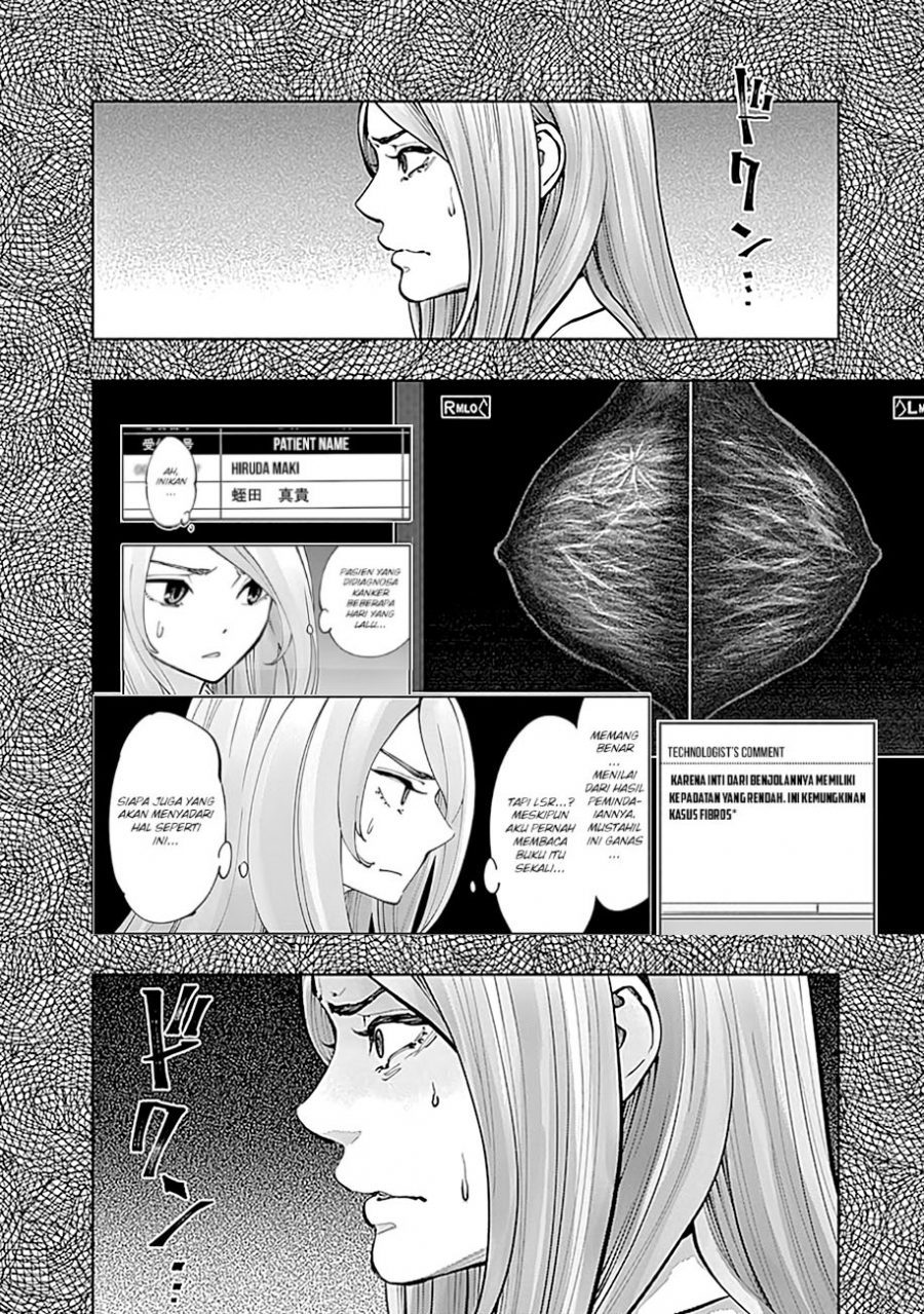 Radiation House Chapter 15 Gambar 11